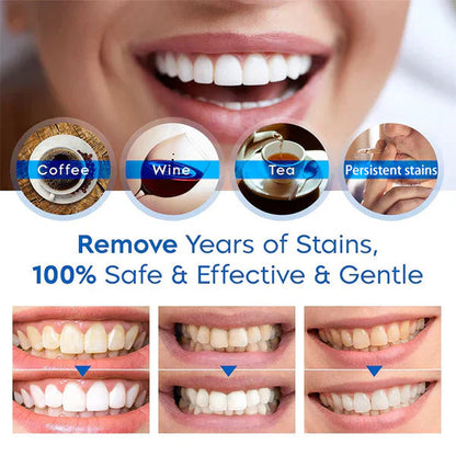 Mavetto™ Teeth Whitening Pen